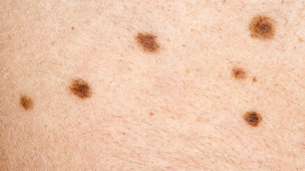 How a Skin Cancer Clinic in Melbourne Supports Early Skin Cancer Detection